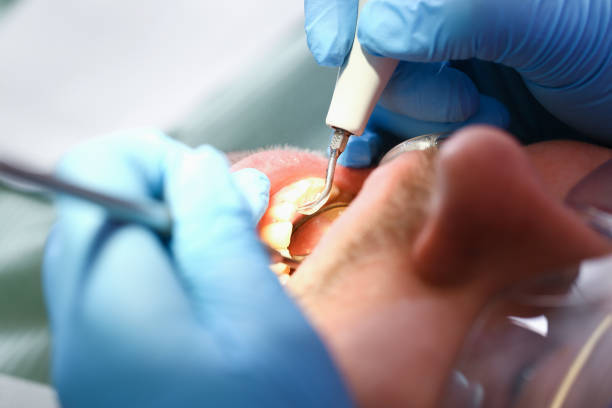 Best Dentist for Tooth Abscess  in Turtle Creek, PA